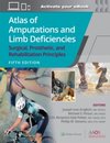 Atlas of Amputations and Limb Deficiencies