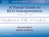 A Visual Guide to ECG Interpretation