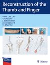 Reconstruction of the Thumb and Finger