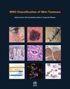Who Classification of Skin Tumours (4TH ed.) 