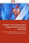 Imagerie non invasive de la plaque d''athérosclérose vulnérable