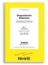 Die Diagnostischen Bilderlisten. Siebungsverfahren zur Früherkennung von Leselernschwierigkeiten im Leselernprozess / Die Diagnostischen Bilderlisten