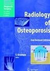 Radiology of Osteoporosis