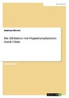 Die Allokation von Organtransplantaten durch Clubs