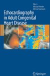 Echocardiography in Adult Congenital Heart Disease