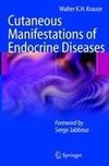 Cutaneous Manifestations of Endocrine Diseases