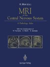 MRI of the Central Nervous System