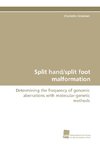 Split hand/split foot malformation