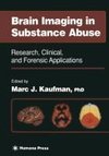 Brain Imaging in Substance Abuse
