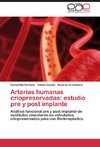 Arterias humanas criopreservadas: estudio pre y post implante