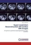 Super-resolution Reconstruction Of Cardiac MR Images