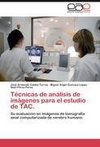 Técnicas de análisis de imágenes para el estudio de TAC.