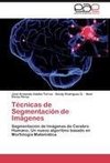 Técnicas de Segmentación de Imágenes