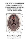 Low Resolution Brain Electromagnetic Tomography (LORETA)