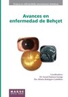 Avances en enfermedad de Behçet