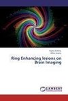 Ring Enhancing lesions on Brain Imaging