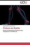 Prótesis de Rodilla