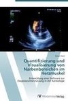 Quantifizierung und Visualisierung von Narbenbereichen im Herzmuskel