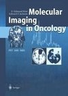 Molecular Imaging in Oncology