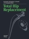 Total Hip Replacement