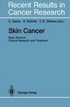 Skin Cancer: Basic Science, Clinical Research and Treatment