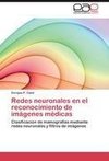 Redes neuronales en el reconocimiento de imágenes médicas