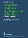 Congenital Dysplasia and Dislocation of the Hip in Children and Adults