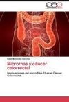 Micrornas y cáncer colorrectal