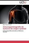 Inmunogammagrafía de tumores de origen epitelial