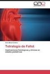 Tetralogía de Fallot