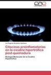 Citocinas proinflamatorias en la cicatriz hipertrófica post-quemadura