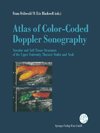 Atlas of Color-Coded Doppler Sonography