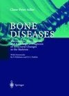 Bone Diseases