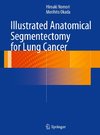 Illustrated Anatomical Segmentectomy for Lung Cancer