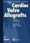 Cardiac Valve Allografts