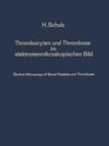 Thrombocyten und Thrombose im elektronenmikroskopischen Bild / Electron Microscopy of Blood Platelets and Thrombosis