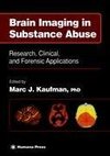 Brain Imaging in Substance Abuse