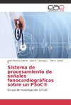 Sistema de procesamiento de señales fonocardiográficas sobre un PSoC®