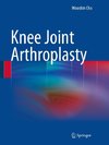 Knee Joint Arthroplasty