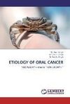 Etiology of Oral Cancer