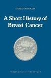 A short history of breast cancer