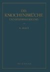 Die Knochenbrüche und ihre Behandlung