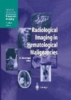 Radiological Imaging in Hematological Malignancies