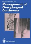 Management of Oesophageal Carcinoma