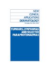 Tumours, Lymphomas and Selected Paraproteinaemias