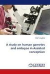 A study on human gametes and embryos in Assisted conception