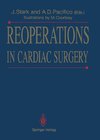 Reoperations in Cardiac Surgery