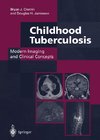 Childhood Tuberculosis: Modern Imaging and Clinical Concepts