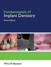 Fundamentals of Implant Dentistry