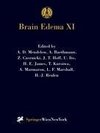 Brain Edema XI